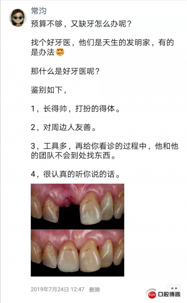 美牙贴面朋友圈文案